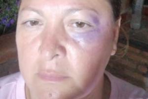 Denuncian presunta agresión de un edil contra una mujer en Granada, Antioquia 