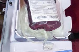 Donación de sangre