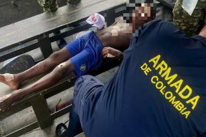 Fuerzas Militares entregaron detalles sobre el hecho donde resultó herido el menor de 9 años de edad por un explosivo instalada por el ELN en Chocó. El menor ya se encuentra en el hospital de Quibdó.