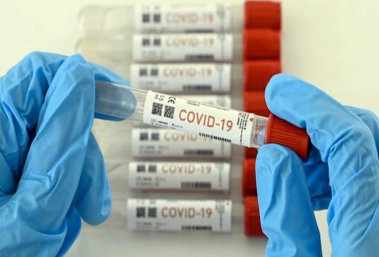 Pruebas Covid-19 imagen de referencia