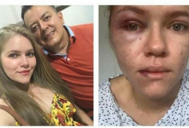 Johana Espejo señala al concejal Deiby Arias de haberla agredido