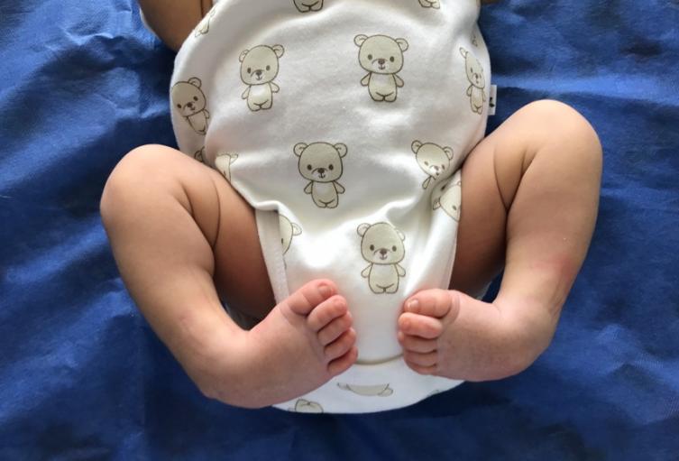 El tratamiento en los bebés.