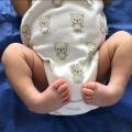 El tratamiento en los bebés.
