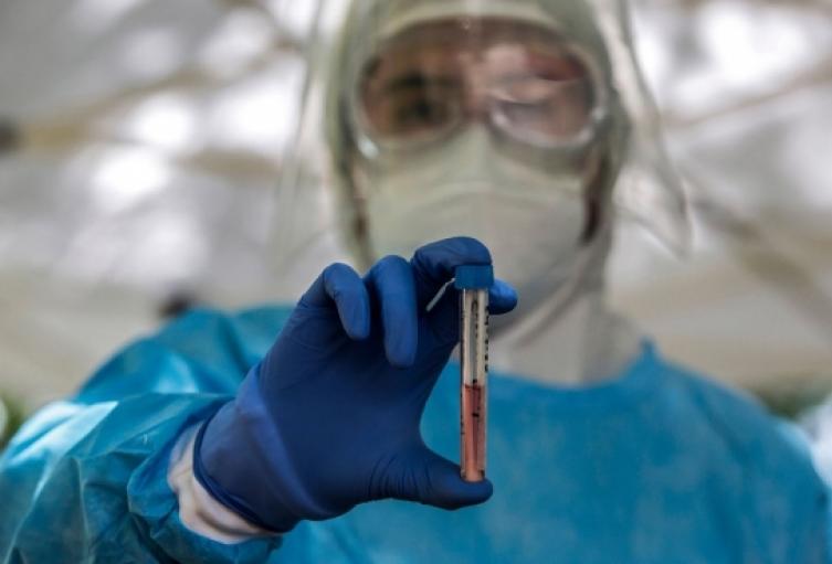 El reporte indicó que hubo un total de 5.147 nuevos casos de Coronavirus en el territorio colombiano