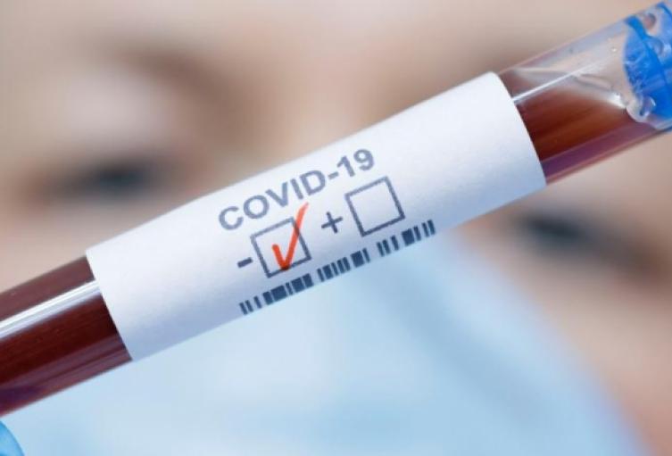 Desde que el nuevo Coronavirus SARS-COV-2 llegó al país, han muerto un total de 28.306 personas