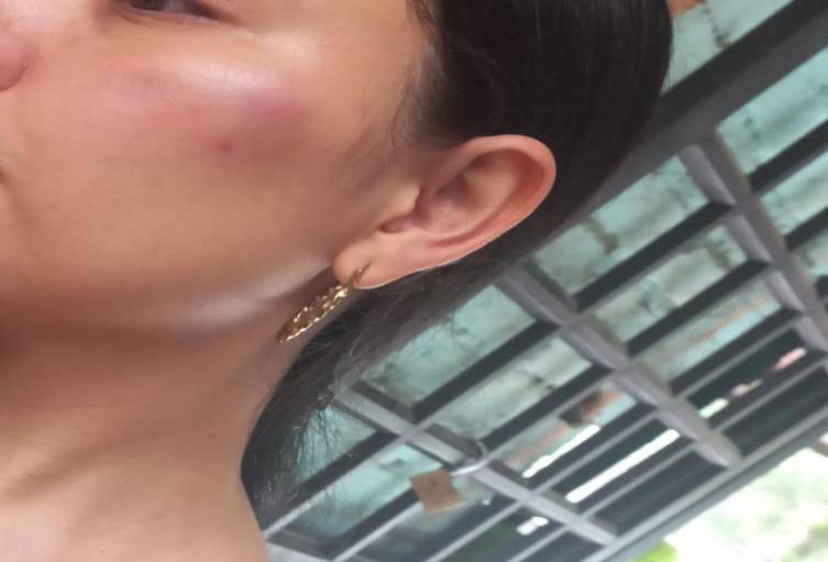 golpe a una mujer