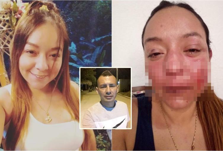 ¡Lo que faltaba! Sujeto podría quedar libre después de agredir salvajemente a mujer ibaguereña