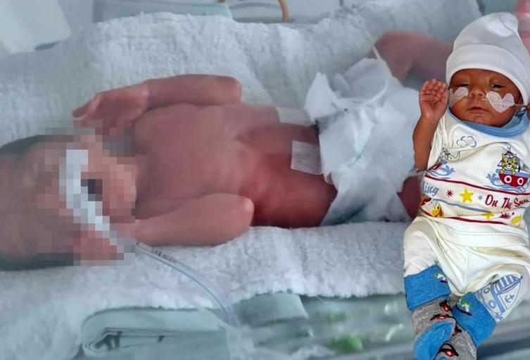 Médicos hicieron 'Vaca' y operaron a un bebé de 2 meses que podía quedar ciego