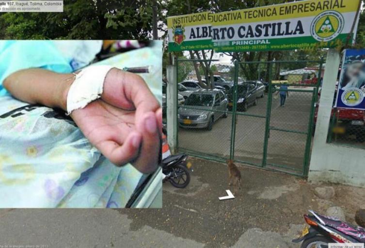 Muere niña del colegio Alberto Castilla