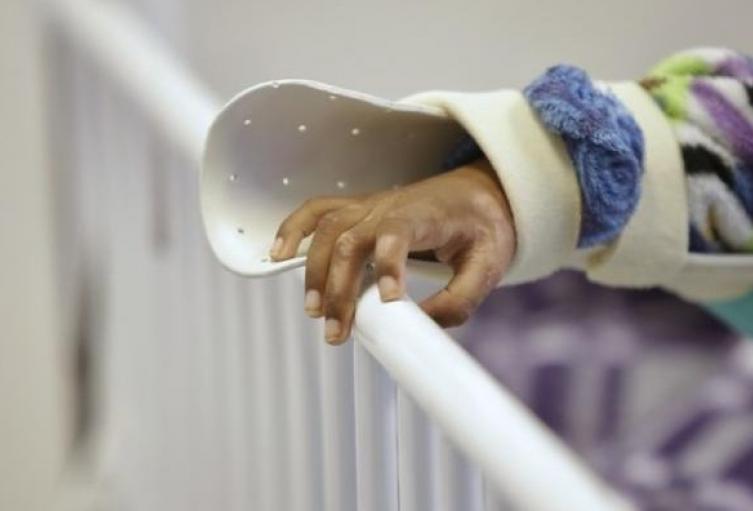 Referencia Menor de edad quemada por pólvora