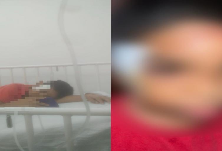 Niño herido en El Espinal 