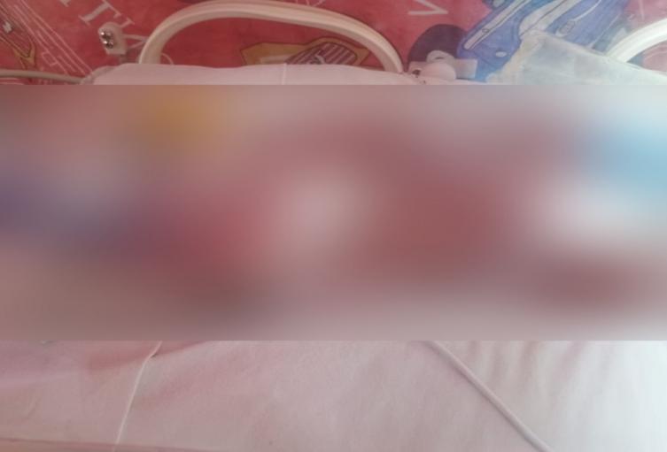 Bebé fallecido en Ibagué