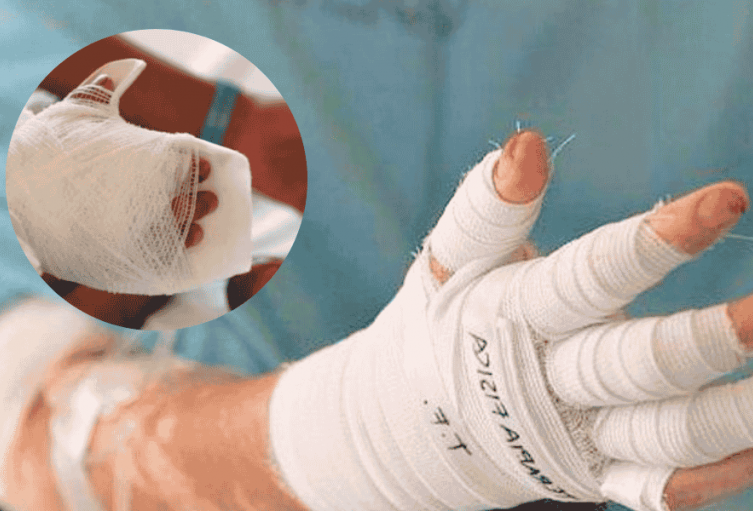 Tolima reporta 27 personas lesionadas por pólvora durante la temporada de fin de año