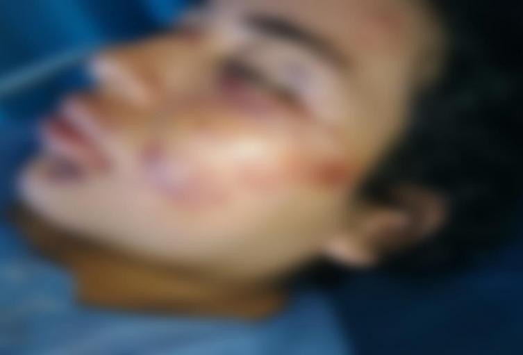 Domiciliaria accidentada