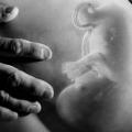 Foto referencial aborto.