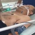 Paciente crítico por cita de odontología Ibagué 