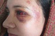Violencia contra la Mujer en el Tolima 