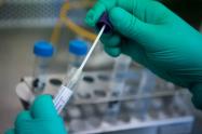  Estos casos son analizados en pruebas de laboratorio para determinar si son positivos o negativos con el virus