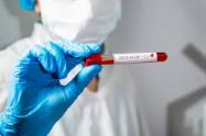 Huila reporta 212 casos por Coronavirus 
