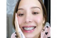 Luisa Fernanda W, ahora con brackets