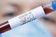 Covid - 19