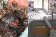Delante del hijo de ella, hombre atacó con un hacha en la cabeza a su pareja en Bogotá