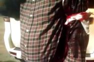 Coronel de la Policía herido con arma traumática