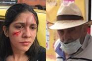 Mujer agredida