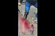 Apuñalado por ladrona en el centro de Bogotá