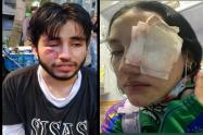 Afectados por manifestaciones