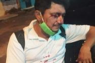 Adolescente lo hirió en el rostro al oponerse a un atraco en Las Américas de Ibagué