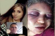 Se conocieron más detalles de la brutal agresión que recibió María Victoria en San Luis – Tolima