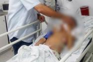 Menor fue herido con arma de fuego en Neiva