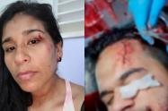 Turistas Tolimenses fueron atacados con cuchillo 