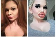 Labios grandes