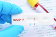 Pruebas caseras de Covid 19