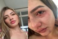 Mujer agredida en un acto de celos e intolerancia