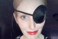 'TikToker' quedó ciega de un ojo temporalmente luego de aplicarse bótox