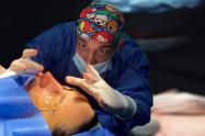 Luis Devoz, cirugía de nariz - rinoplastia