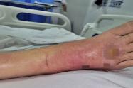 Pie con erupciones cutáneas en mal estado