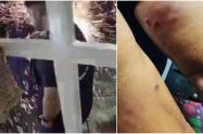 Familia resultó quemada por culpa de un volador que lanzó un vecino