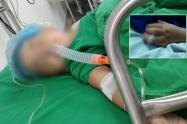 Niña de 3 años fue mordida por Bulldog en Las Ferias y su dueño no responde por la reconstrucción del dedito de la pequeña