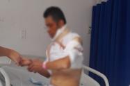 Brutal ataque con ácido en la cara y pecho recibió un hombre en el barrio Santander - Estadio en Ibagué