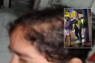 Sujeto agredió a dos mujeres, madre e hija, que viven del reciclaje en Mariquita