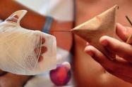 Lesionados por pólvora 