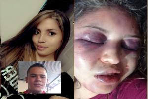 Se conocieron más detalles de la brutal agresión que recibió María Victoria en San Luis – Tolima