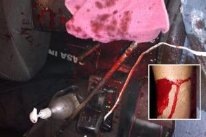 Apuñalaron mulero por intentar robarlo por la variante del Salado