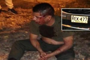 Policía anuncia ‘mano dura’ contra el uniformado borracho que protagonizó accidente en Ibagué