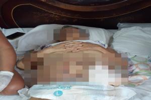 Mal procedimiento quirúrgico 