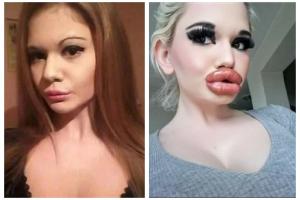 Labios grandes